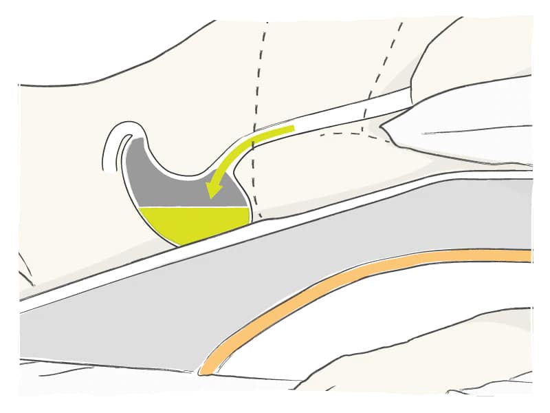 Illustration showing how an inclined sleeping position, with the wedge pillow, prevents acid reflux