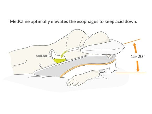 Diagram showing MedCline wedge elevates the upper body 15–20 degrees to keep acid down and reduce reflux